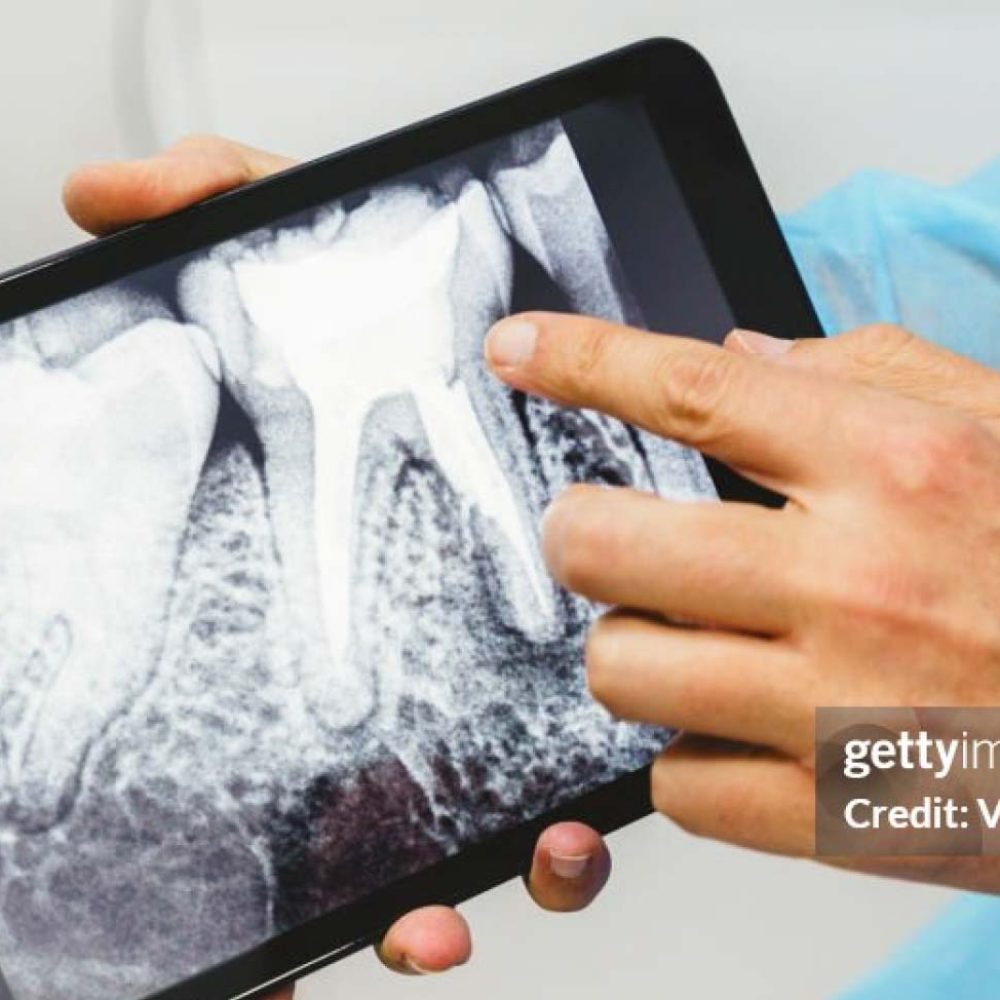 Leistungen-Endodontie-web