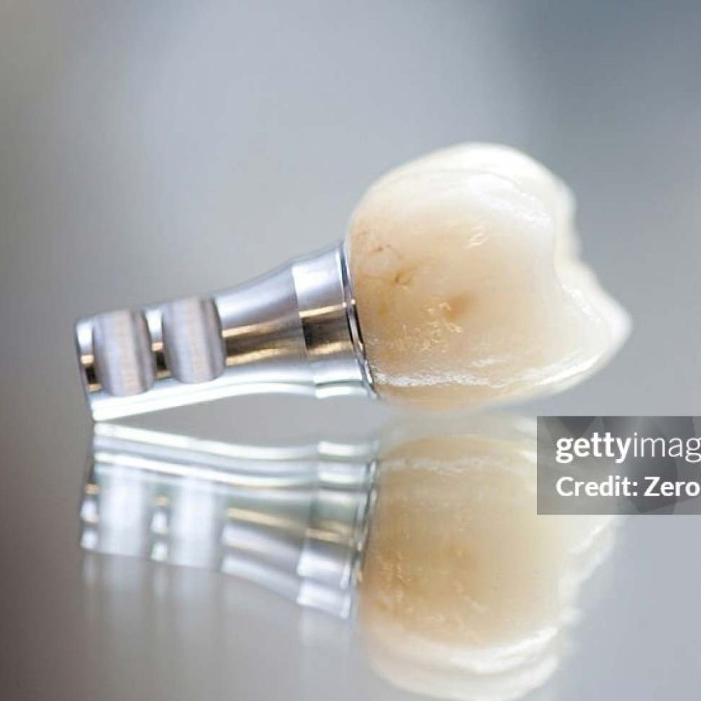 Leistungen-Zahnersatz-web